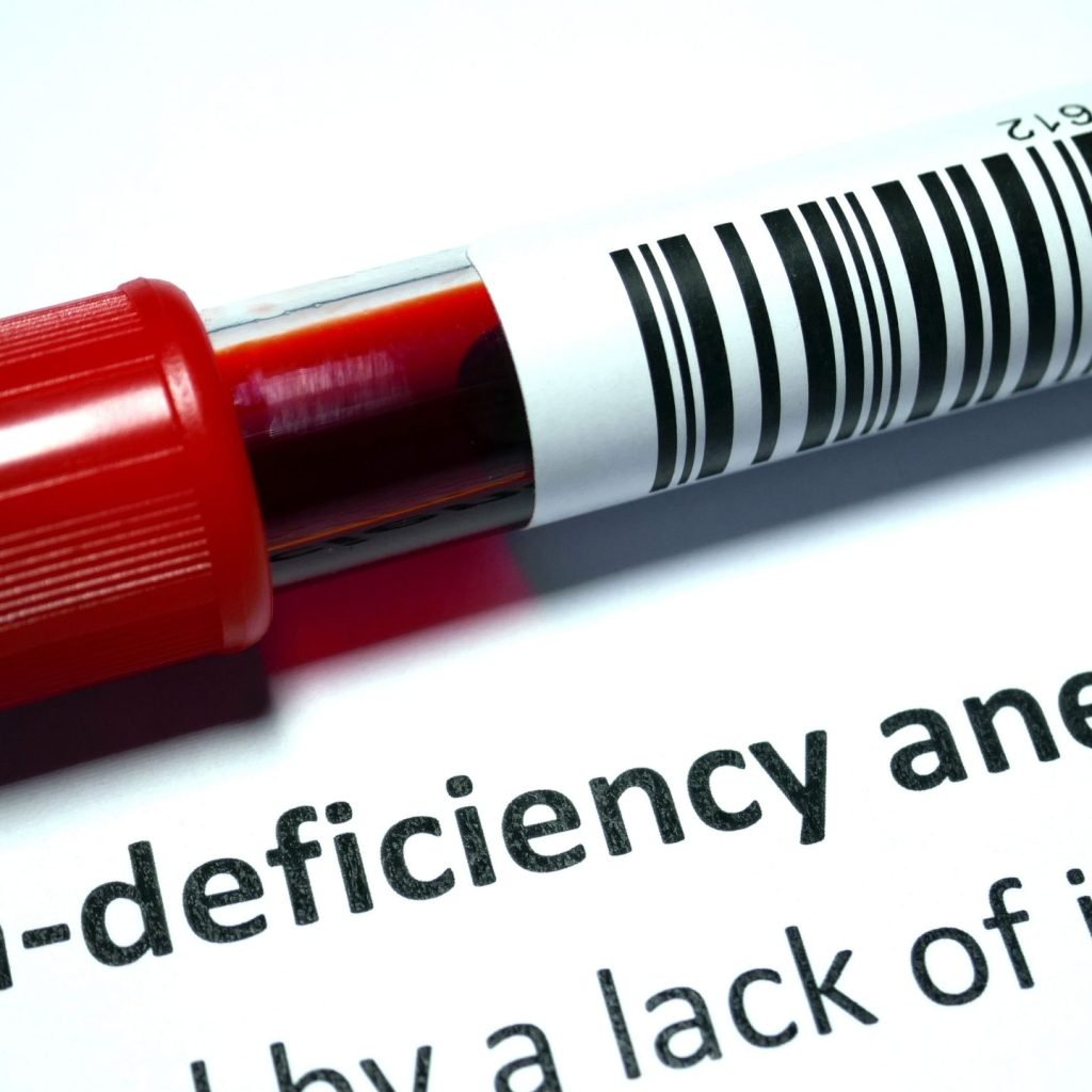 Image showing a blood sample being tested for iron deficiency anemia.