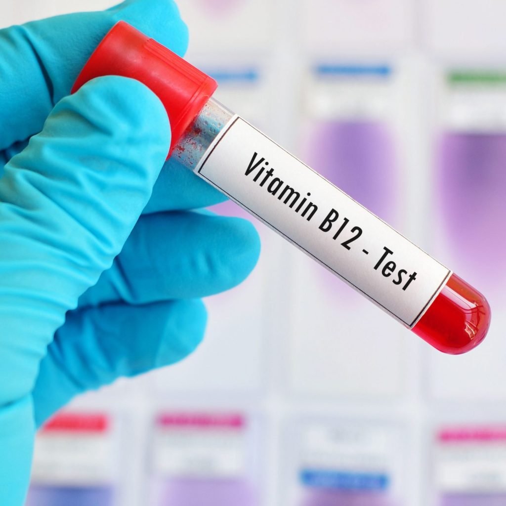 Image of a blood sample being tested for Vitamin B12 deficiency.