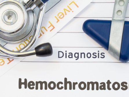 Hemochromatosis (iron overload) can be diagnosed and treated.