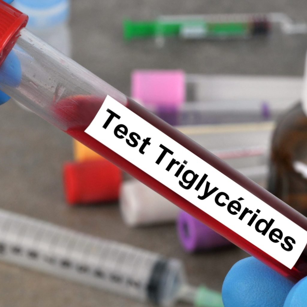 An image showing a blood sample being tested for high triglycerides.