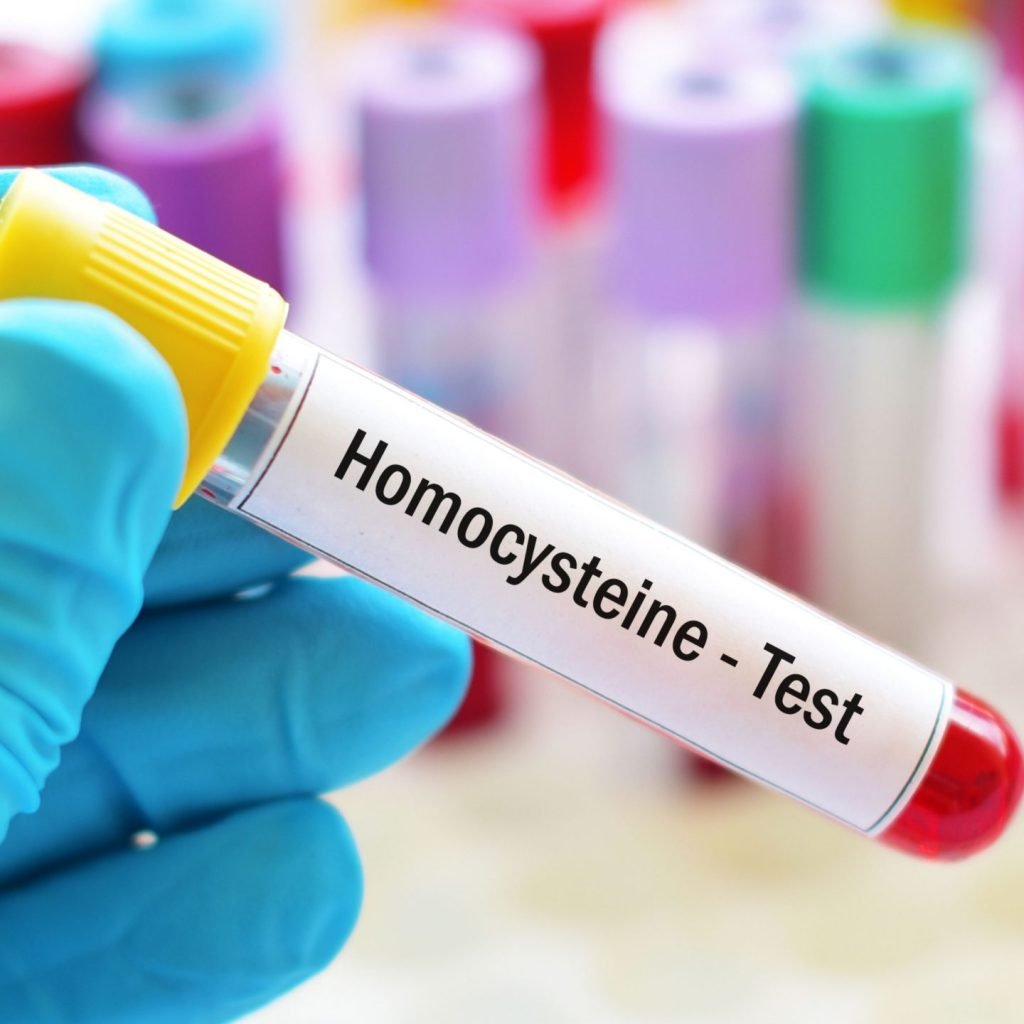 An image showing a blood sample being tested for homocysteine levels.