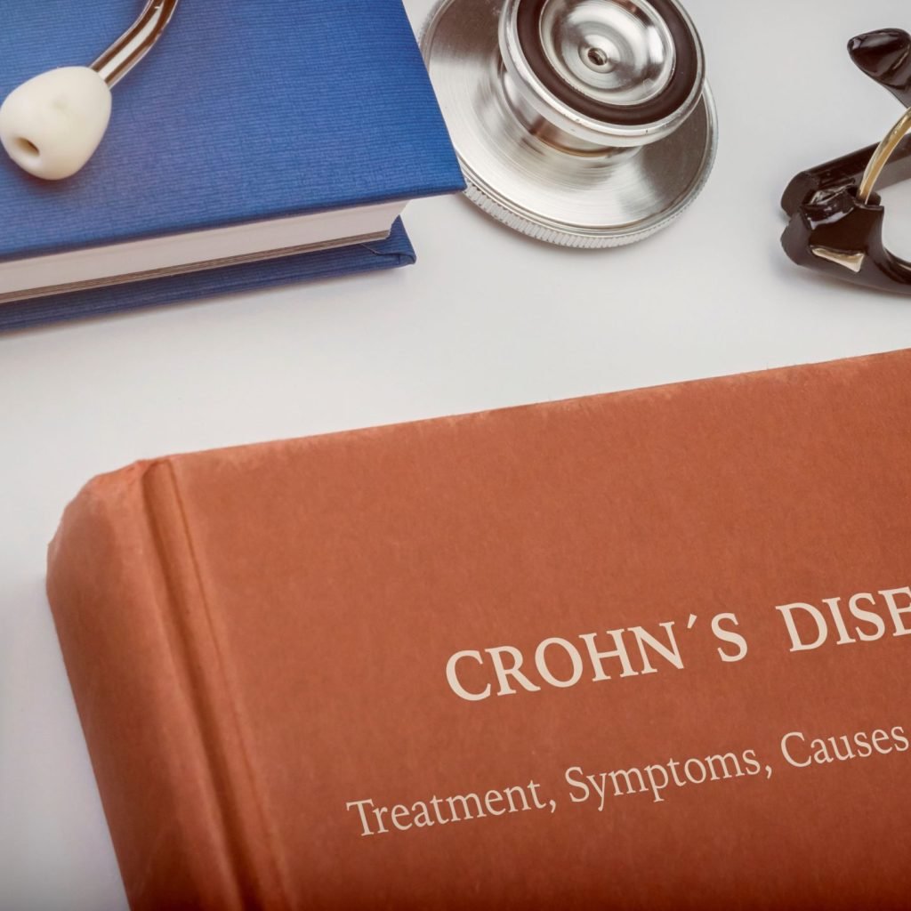 An image showing a medical book on Crohn's disease.