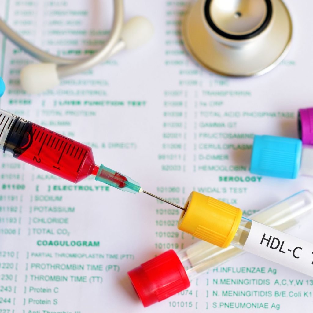 An image of a blood sample being tested for HDL cholesterol, also known as good cholesterol.