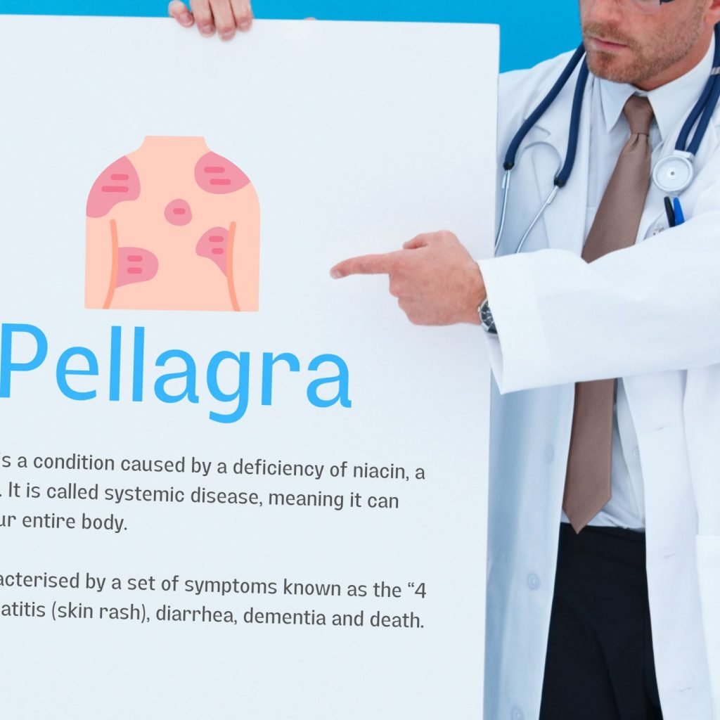 An image of a doctor pointing to a placard about Pellagra, a condition caused by a deficiency of niacin.