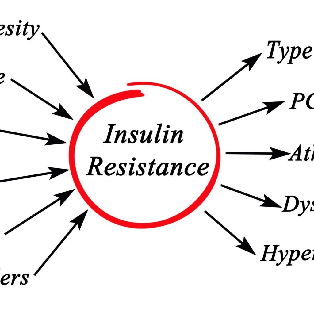 Causes and risk factors of Insulin Resistance.