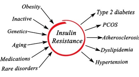 Causes and risk factors of Insulin Resistance.