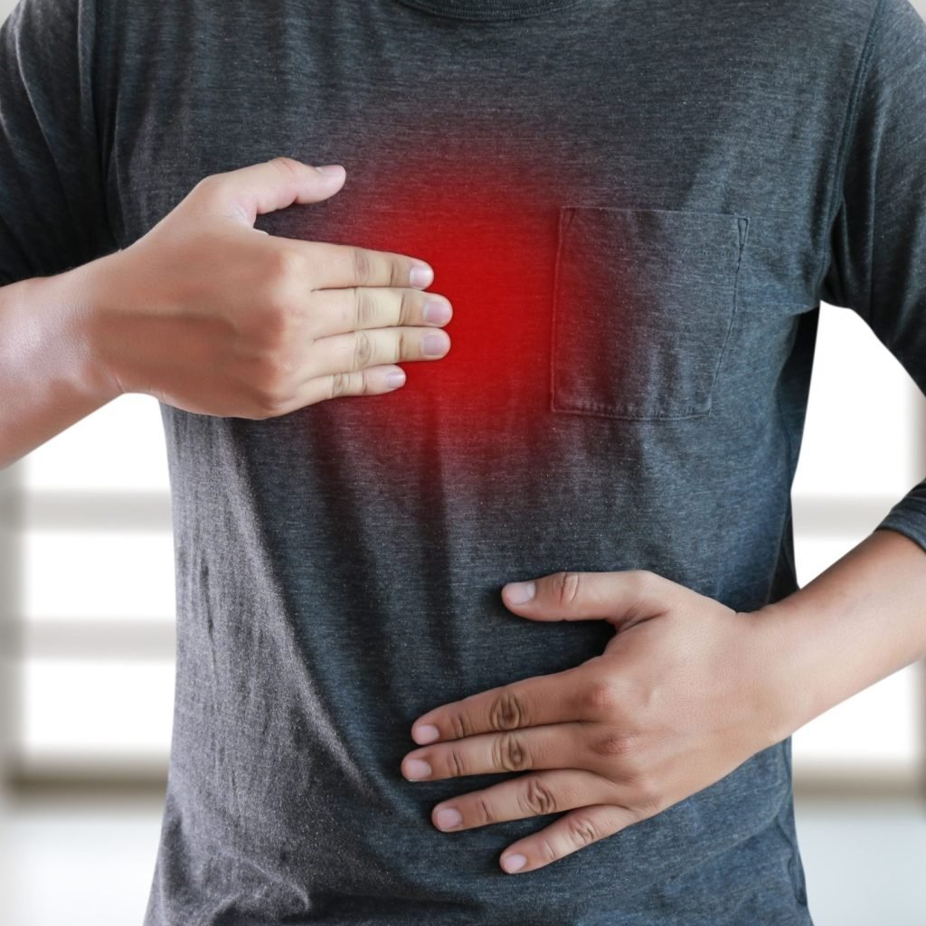A man suffering from symptomatic acid reflux disease (GERD).