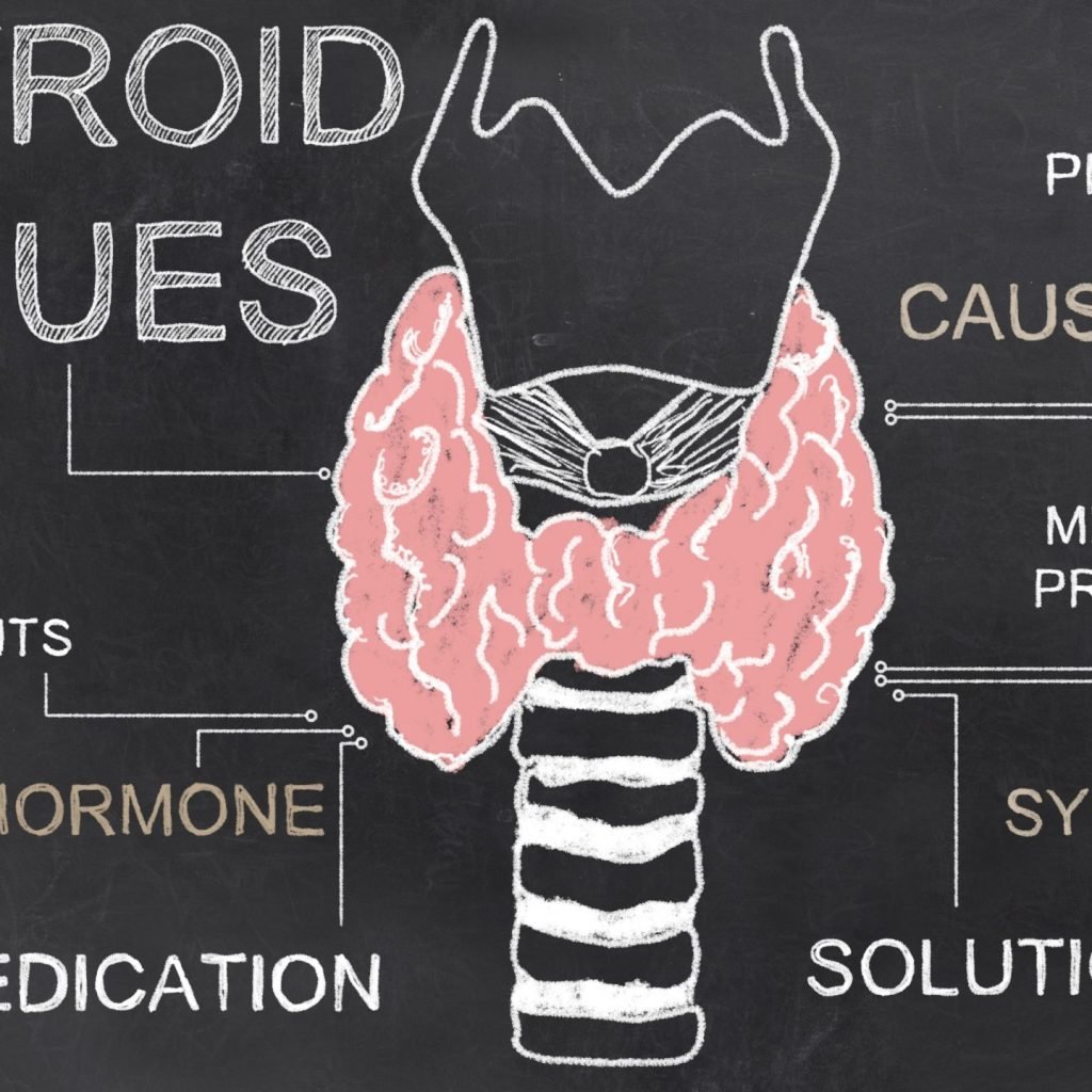 Hyperthyroidism issues illustrated with chalk on a blackboard.