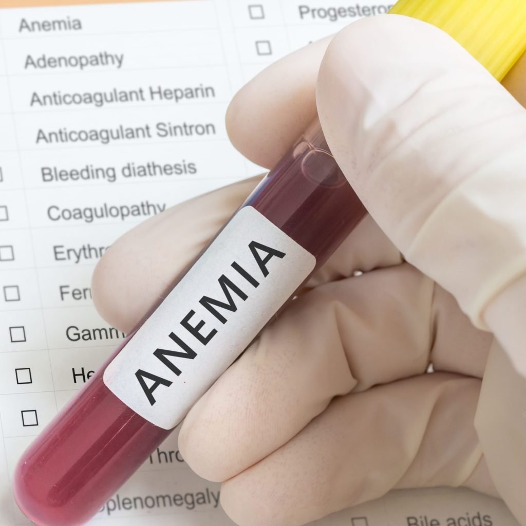 A researcher holds a test tube with blood for anemia test.