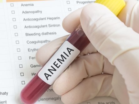 A researcher holds a test tube with blood for anemia test.