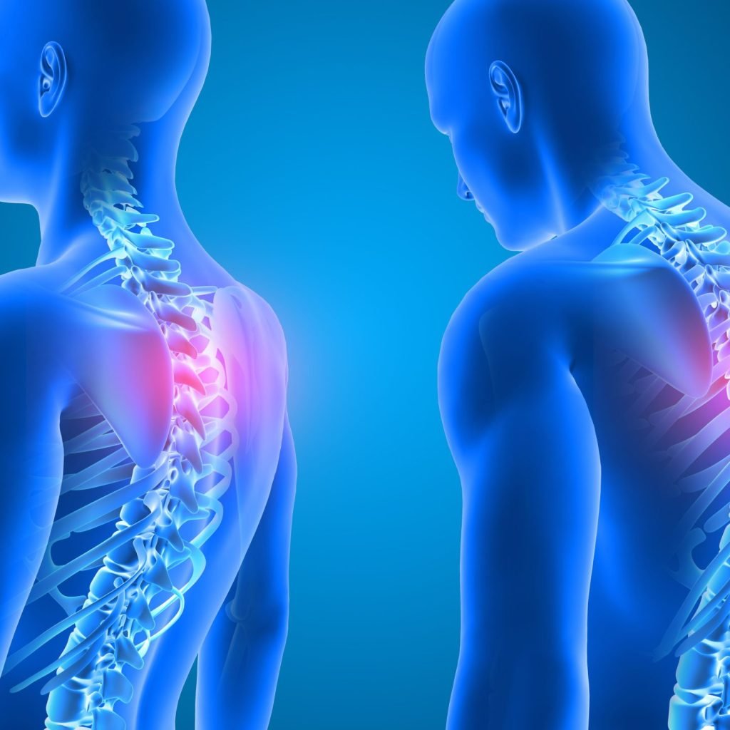 A 3D render of the difference between good posture and bad posture.