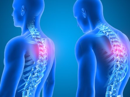 A 3D render of the difference between good posture and bad posture.